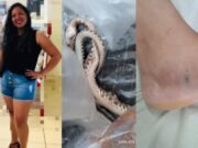 Mulher morta por picada de jararaca recebeu 8 ampolas de soro