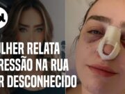 Mulher diz ter sido agredida na rua após bater carro em SP: ‘Deu cabeçada’