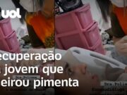 Jovem que teve reação alérgica após cheirar pimenta responde a estímulos; veja