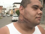 Fio solto de poste ‘rasga’ rosto de entregador de marmitex que leva 25 pontos em MG