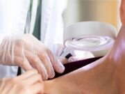 Desinformação ainda é obstáculo para diagnóstico e tratamento de hanseníase