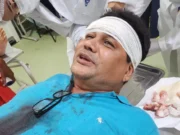 Ex-vereador de VG é agredido por lutador de jiu-jitsu ao tentar ajudar vítima de acidente