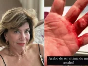 ‘Me estrangulou, rasgou meu dedo’: Silvia Poppovic dá detalhes de assalto