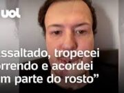 Homem é assaltado, tropeça correndo e acorda sem parte do rosto no hospital; veja