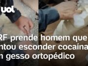 PRF prende traficante que tentou esconder cocaína em gesso ortopédico; veja