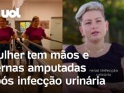 Mulher tem mãos e pernas amputadas após infecção urinária: ‘Sou grata por estar viva’