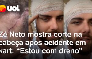 Zé Neto mostra ferimento na cabeça após acidente em kart: ‘Corte foi bem grande’