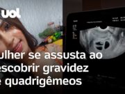 Mulher se assusta ao descobrir quadrigêmeos e médico brinca: ‘Os 4 bebês estão em festa’