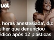 Mulher esperava quatro cirurgias e médico fez 12 procedimentos: ‘Quero justiça’