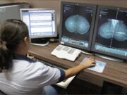 12 mil mulheres aguardam na fila do exame de mama em MT