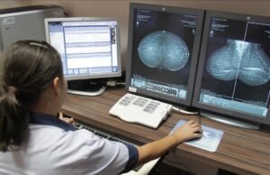 12 mil mulheres aguardam na fila do exame de mama em MT