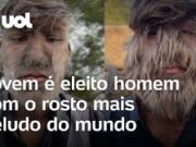 Jovem entra para Guinness Book como homem com o rosto mais peludo do mundo