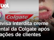 Anvisa interdita creme dental após clientes relatarem aftas e inchaço com o uso; veja