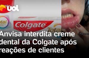 Anvisa interdita creme dental após clientes relatarem aftas e inchaço com o uso; veja