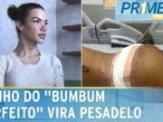 Influenciadora descobre substância perigosa após procedimento estético