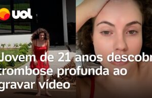 Jovem de 21 anos descobre trombose profunda na perna ao gravar vídeo