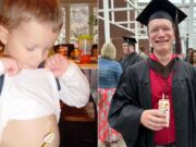 Homem com doença rara passa 20 anos comendo apenas três alimentos; veja