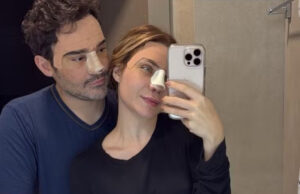 Fernando Zor e noiva fazerm cirurgia plástica juntos após reconciliação: ‘Felizes’