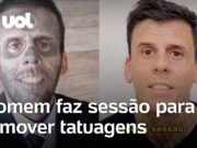 Veja Vídeo – Homem que já foi considerado o mais tatuado do Brasil faz remoção após se tornar cristão