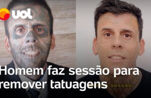Veja Vídeo – Homem que já foi considerado o mais tatuado do Brasil faz remoção após se tornar cristão