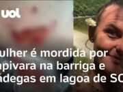 Veja Vídeo – Mulher tem parte de nádega arrancada em ataque de capivara: ‘Dor violenta’