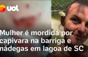 Veja Vídeo – Mulher tem parte de nádega arrancada em ataque de capivara: ‘Dor violenta’